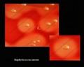 staphylococcus aureus